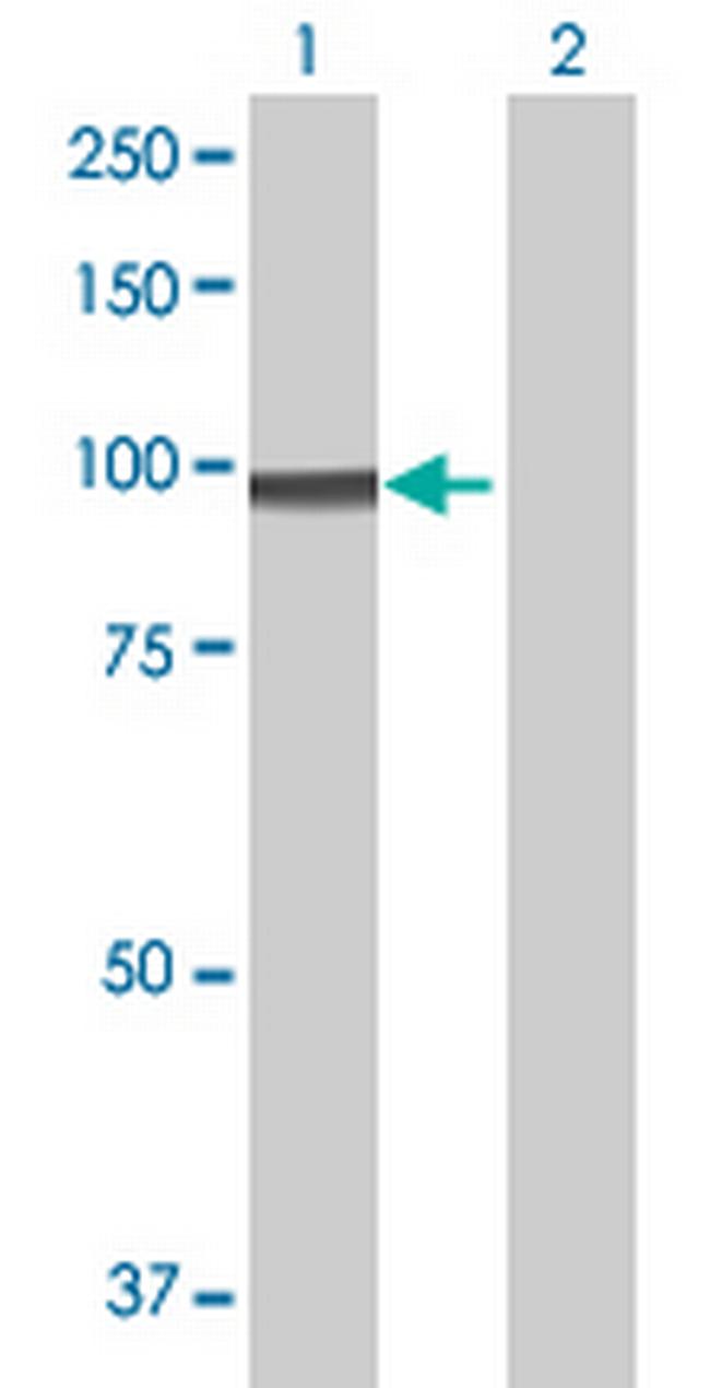 ZNF16 Antibody in Western Blot (WB)