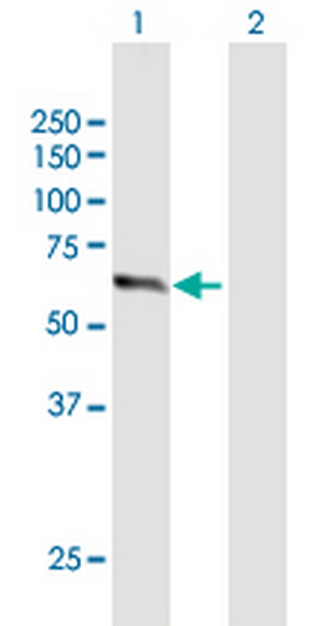 ZNF18 Antibody in Western Blot (WB)
