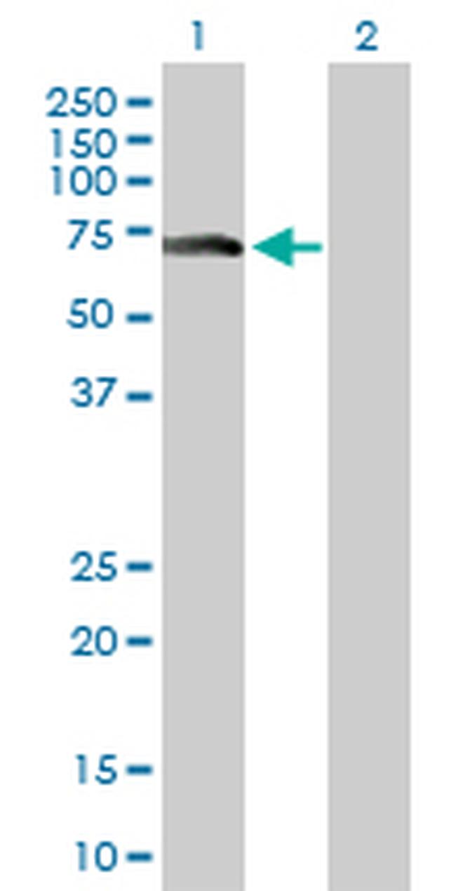 ZNF18 Antibody in Western Blot (WB)