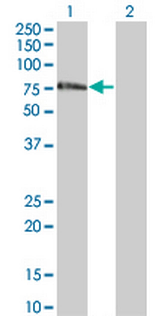 ZNF18 Antibody in Western Blot (WB)