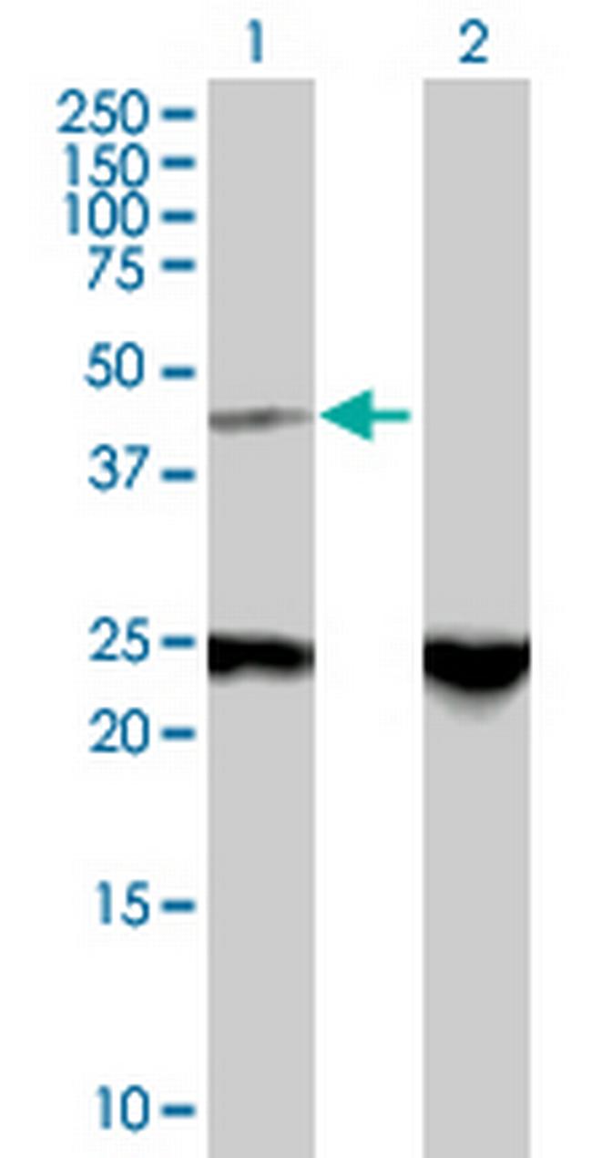 ZNF24 Antibody in Western Blot (WB)