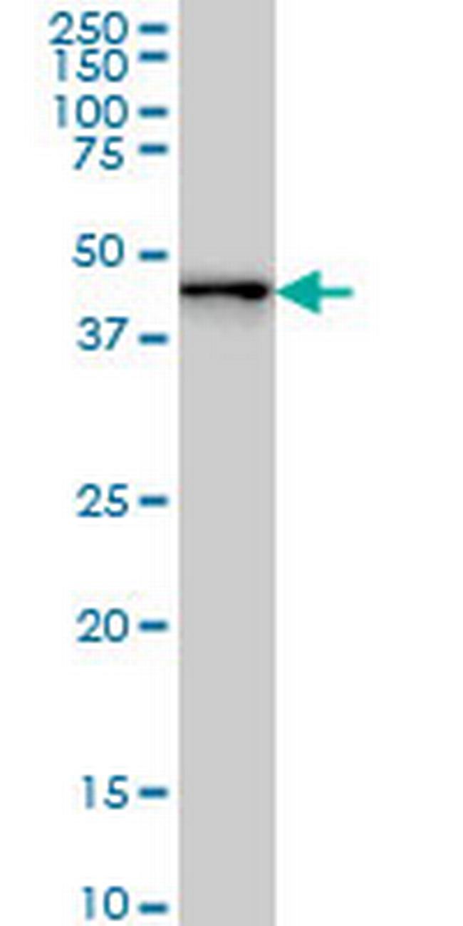 ZNF24 Antibody in Western Blot (WB)