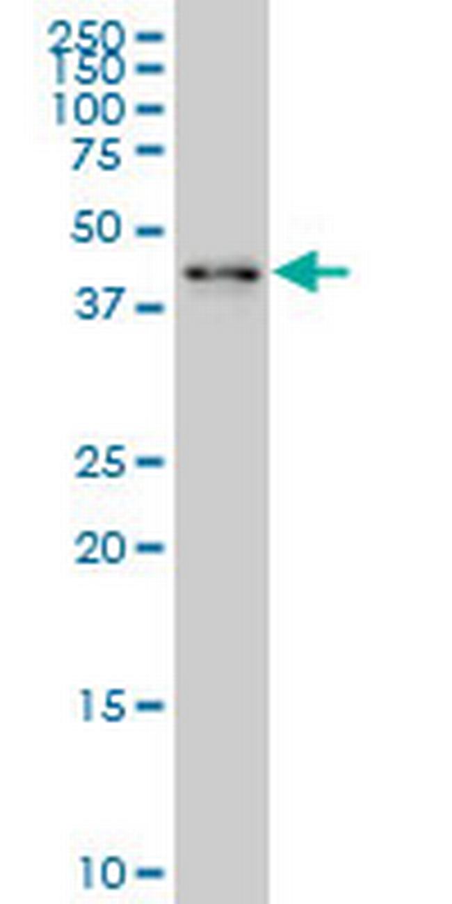 ZNF24 Antibody in Western Blot (WB)