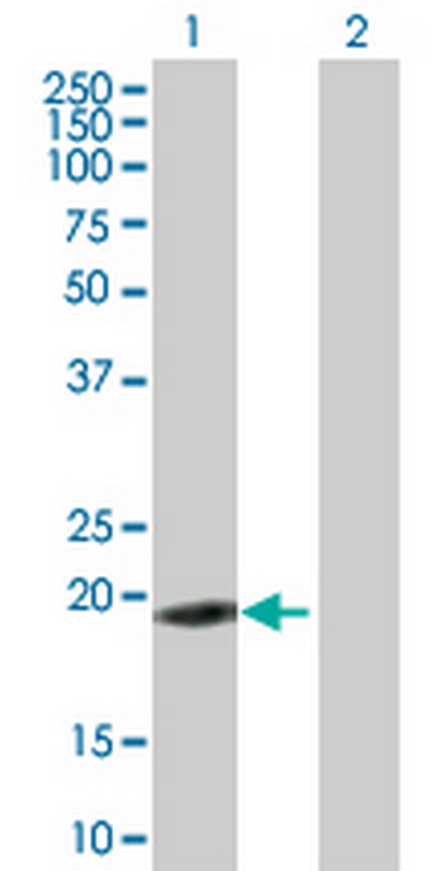 ZNF26 Antibody in Western Blot (WB)