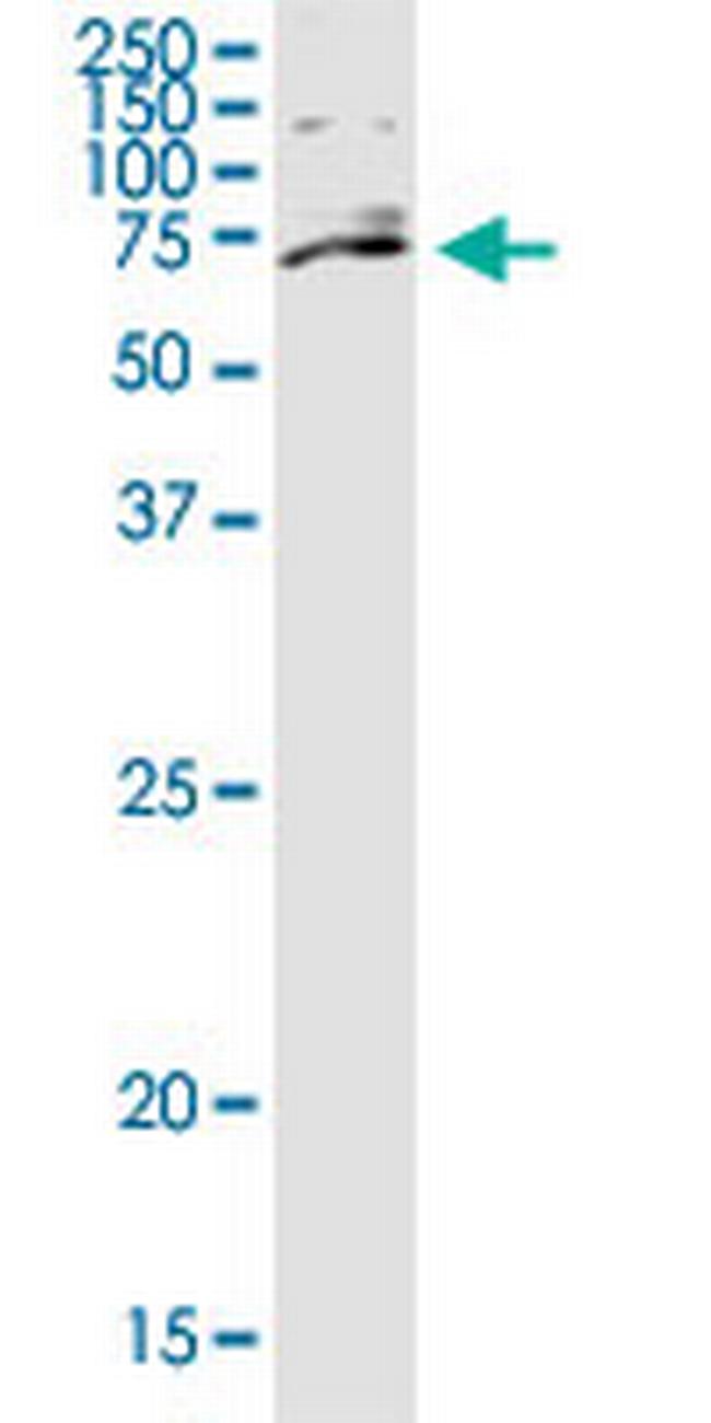 ZNF28 Antibody in Western Blot (WB)
