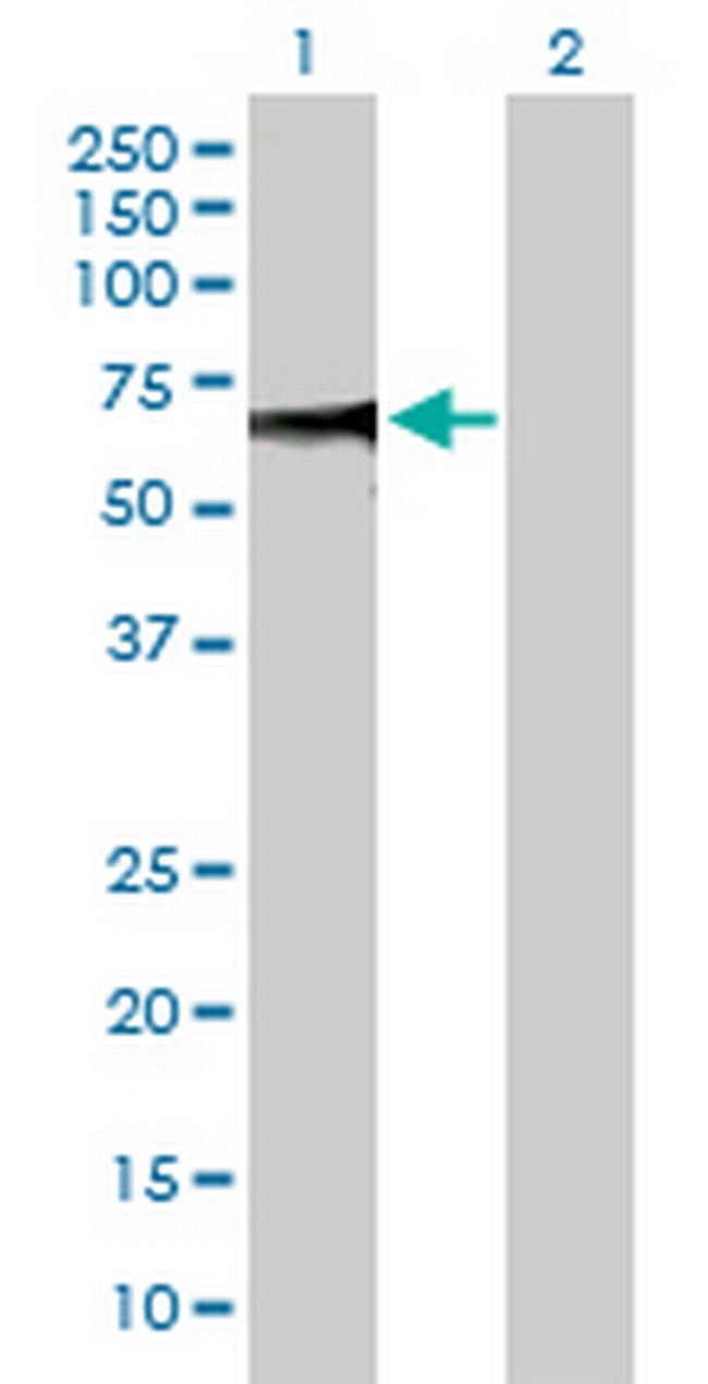 ZSCAN20 Antibody in Western Blot (WB)