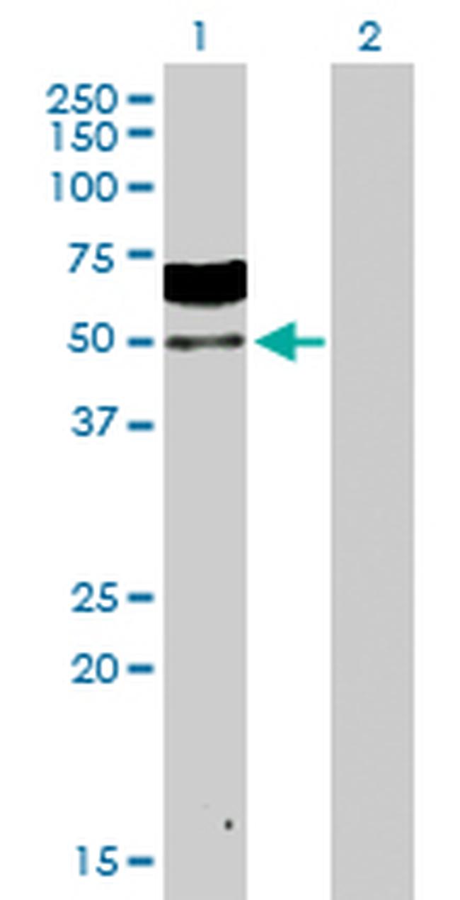 ZSCAN20 Antibody in Western Blot (WB)