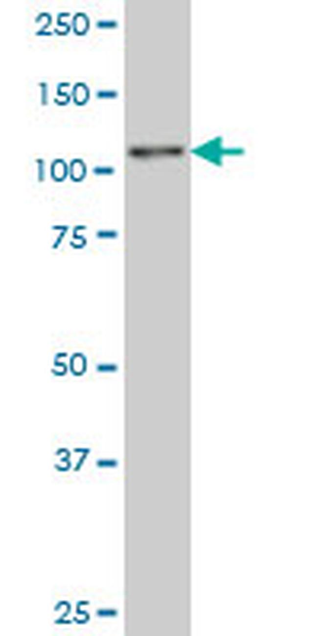 ZNF31 Antibody in Western Blot (WB)