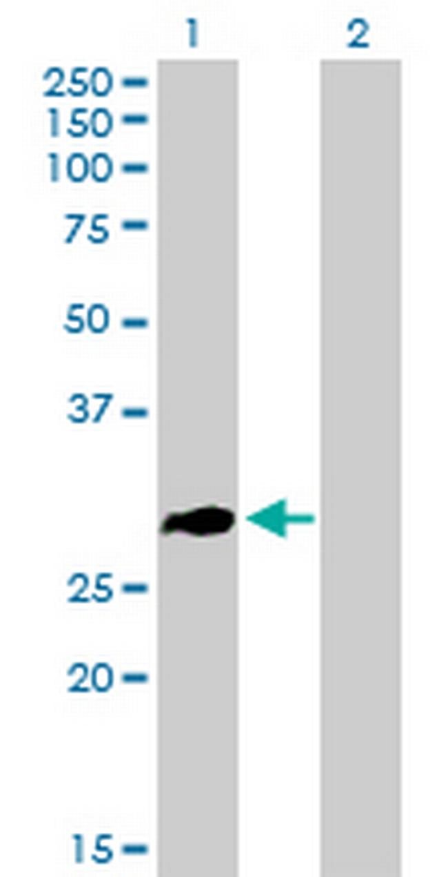 ZNF32 Antibody in Western Blot (WB)