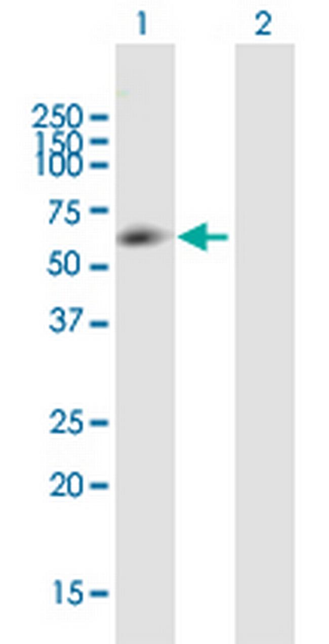ZNF35 Antibody in Western Blot (WB)