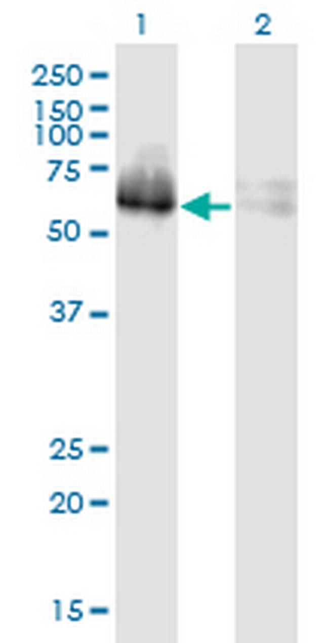 ZNF35 Antibody in Western Blot (WB)