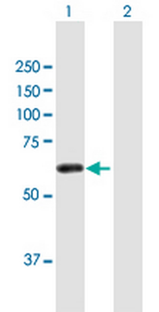 ZSCAN21 Antibody in Western Blot (WB)