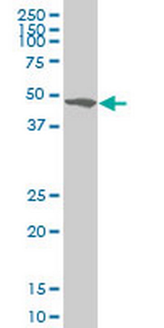 ZSCAN21 Antibody in Western Blot (WB)