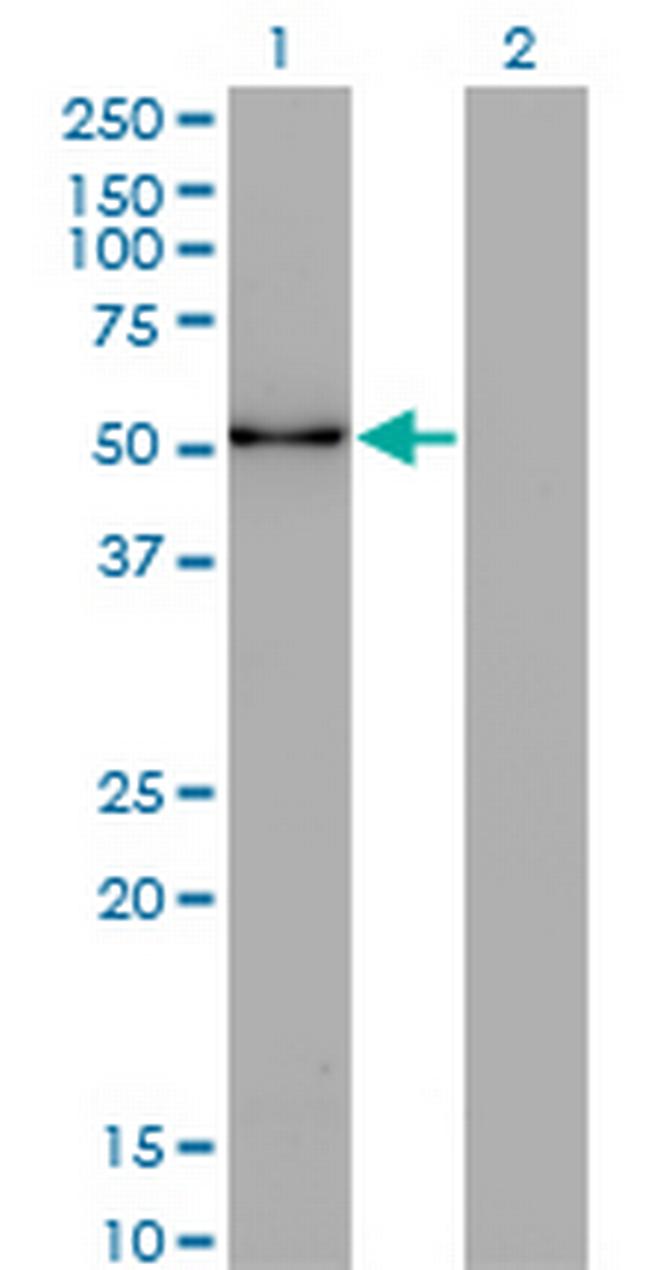 ZSCAN21 Antibody in Western Blot (WB)