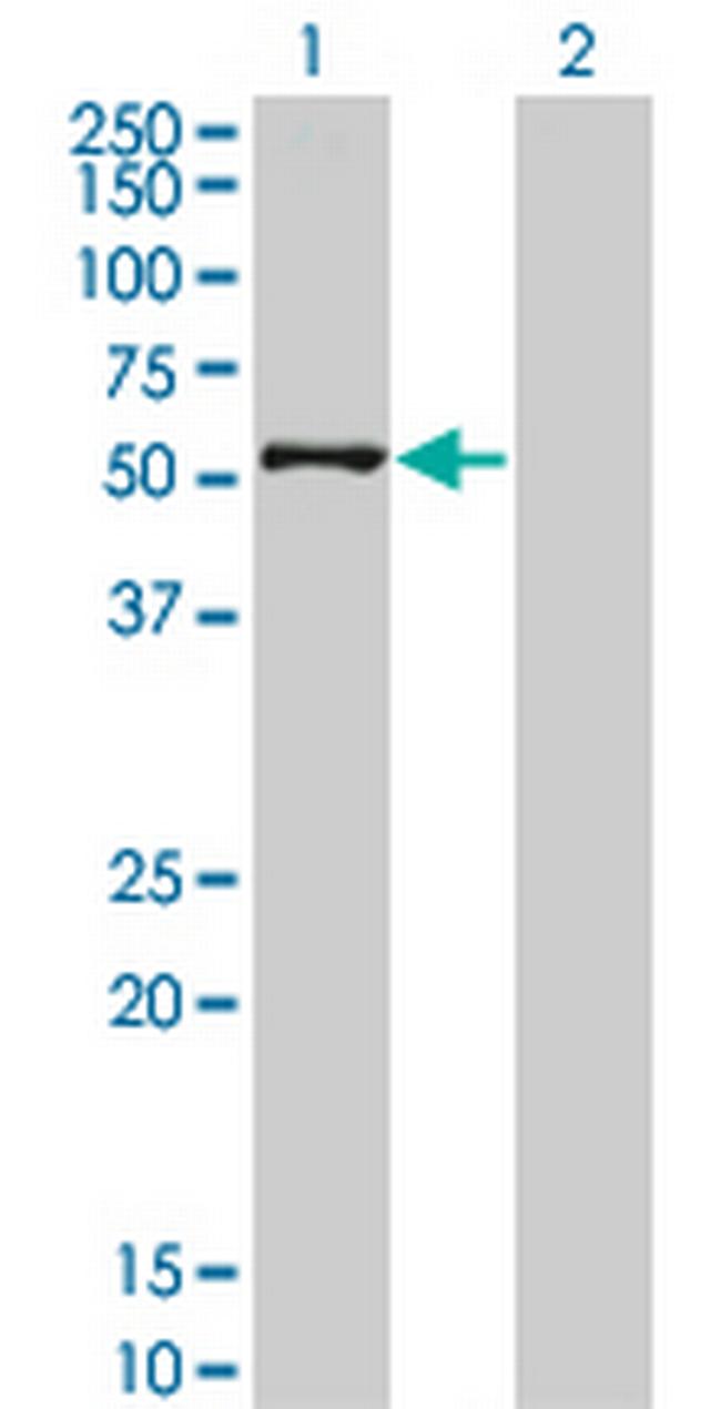 ZSCAN21 Antibody in Western Blot (WB)