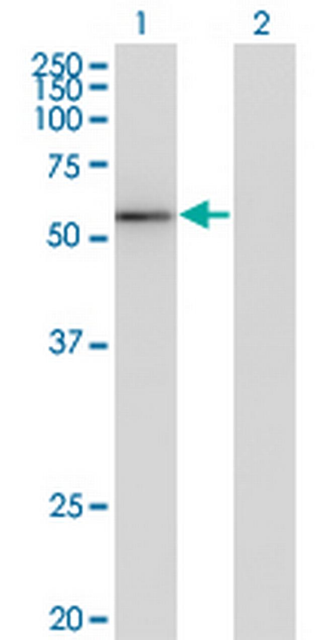 ZNF70 Antibody in Western Blot (WB)