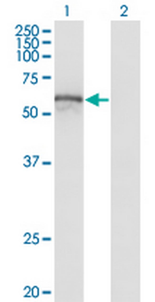 ZNF70 Antibody in Western Blot (WB)