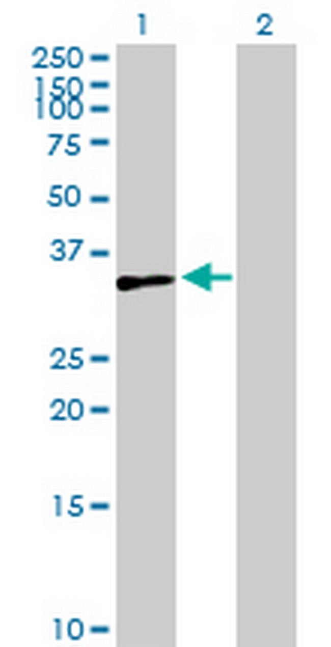 ZNF75A Antibody in Western Blot (WB)