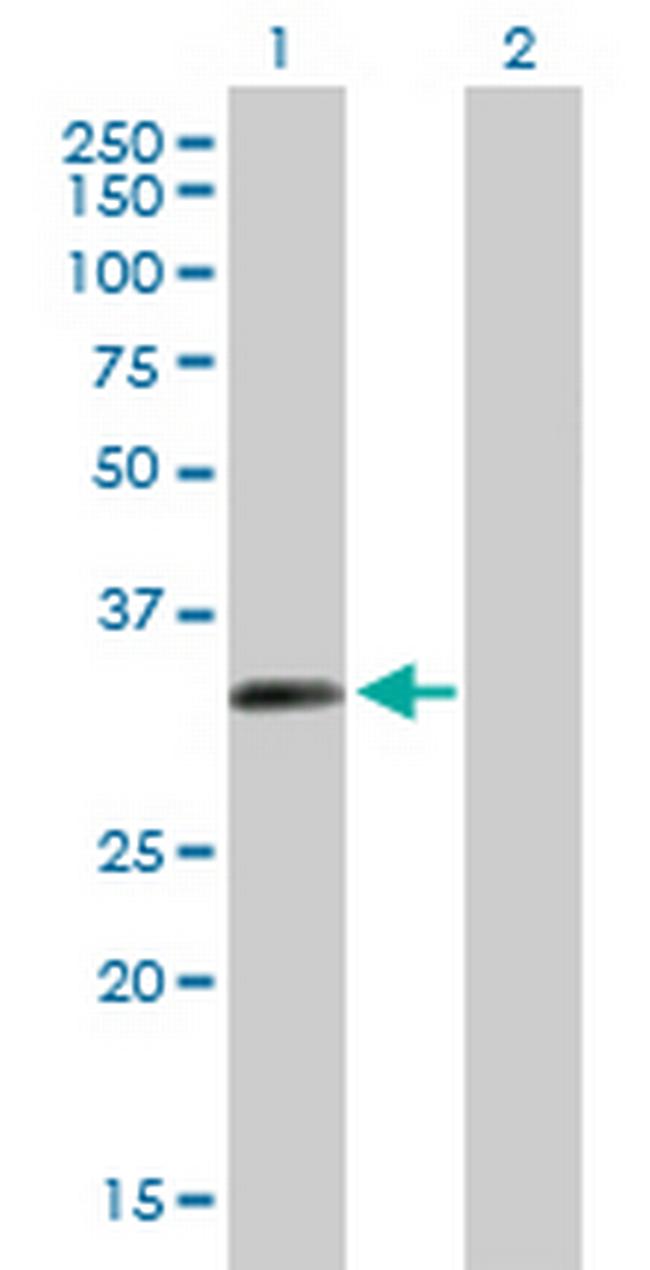 ZNF124 Antibody in Western Blot (WB)
