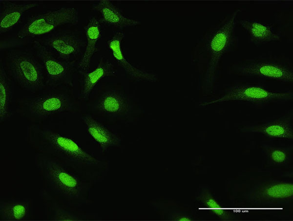 ZNF124 Antibody in Immunocytochemistry (ICC/IF)