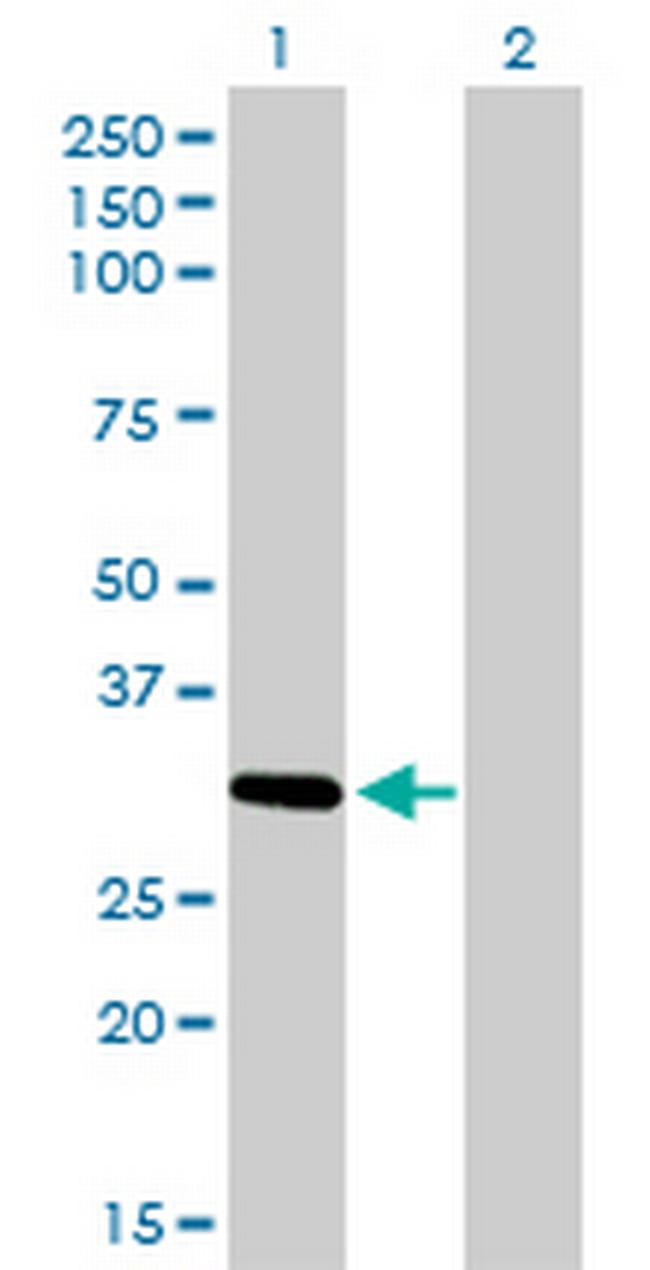 ZNF124 Antibody in Western Blot (WB)