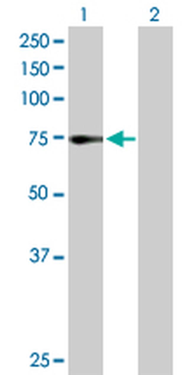 ZNF133 Antibody in Western Blot (WB)