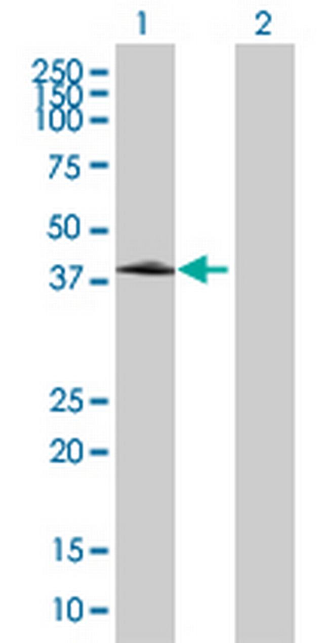 ZNF134 Antibody in Western Blot (WB)