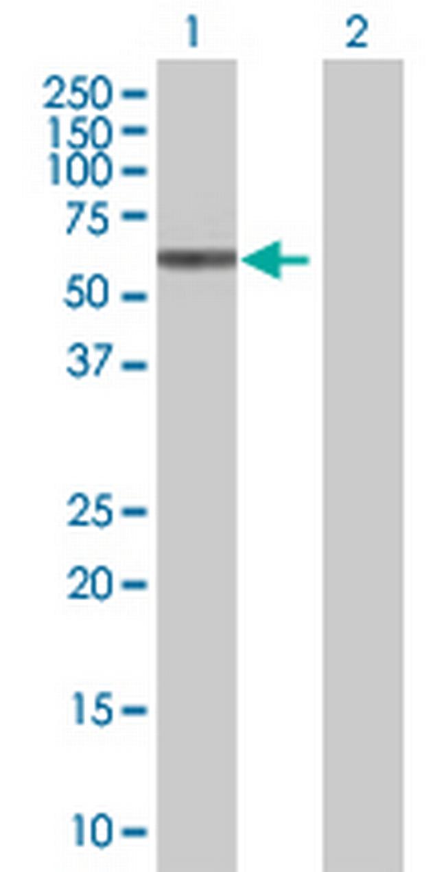 ZNF136 Antibody in Western Blot (WB)