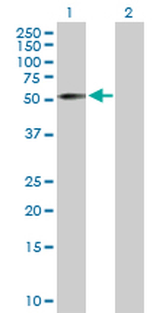 ZNF136 Antibody in Western Blot (WB)