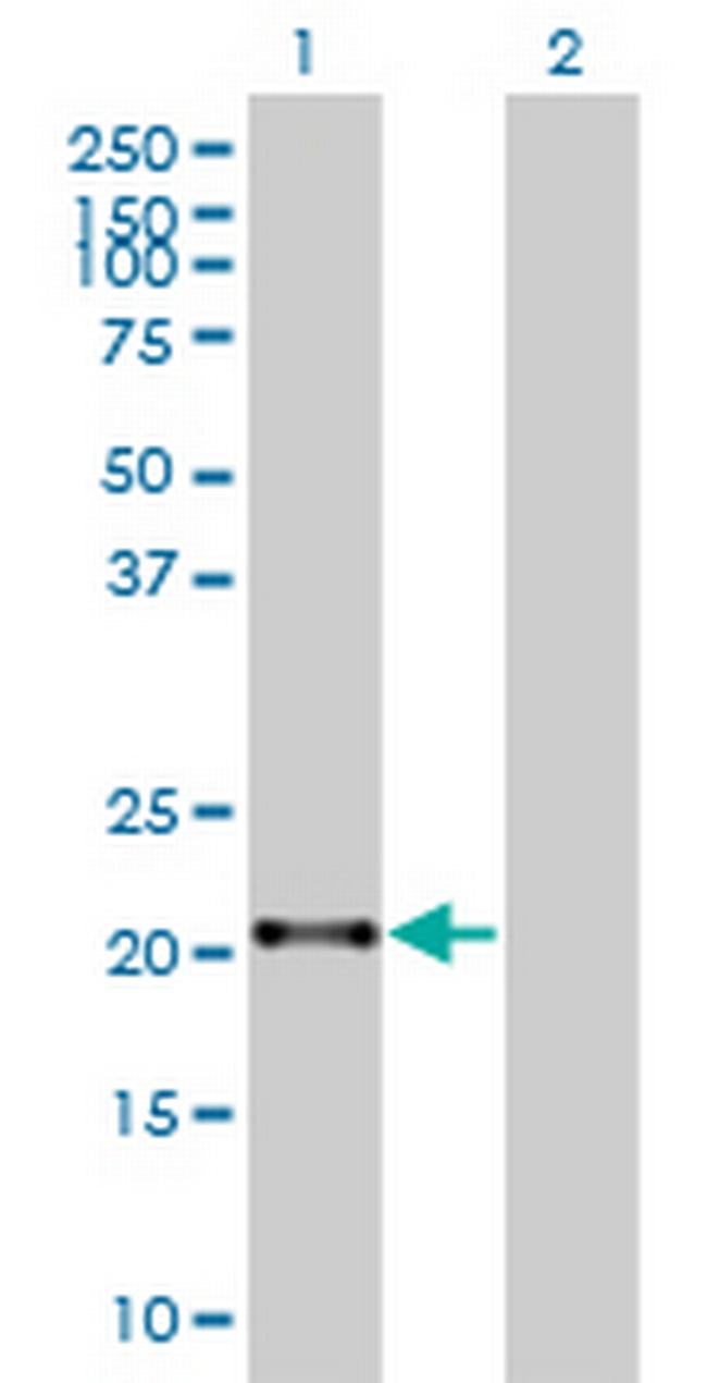 ZNF137 Antibody in Western Blot (WB)