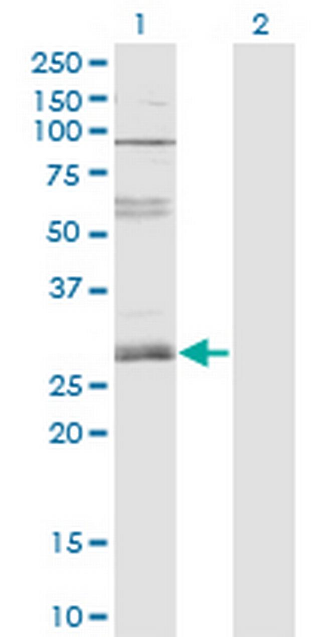 ZNF138 Antibody in Western Blot (WB)