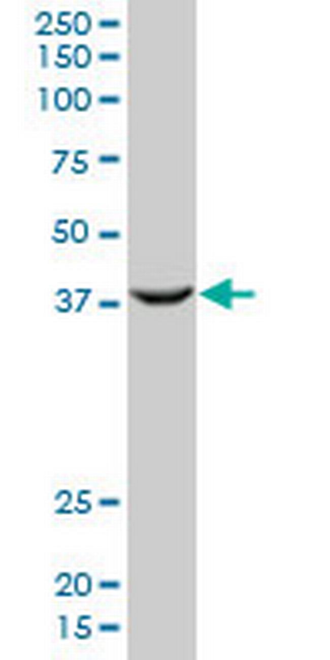 PCGF2 Antibody in Western Blot (WB)