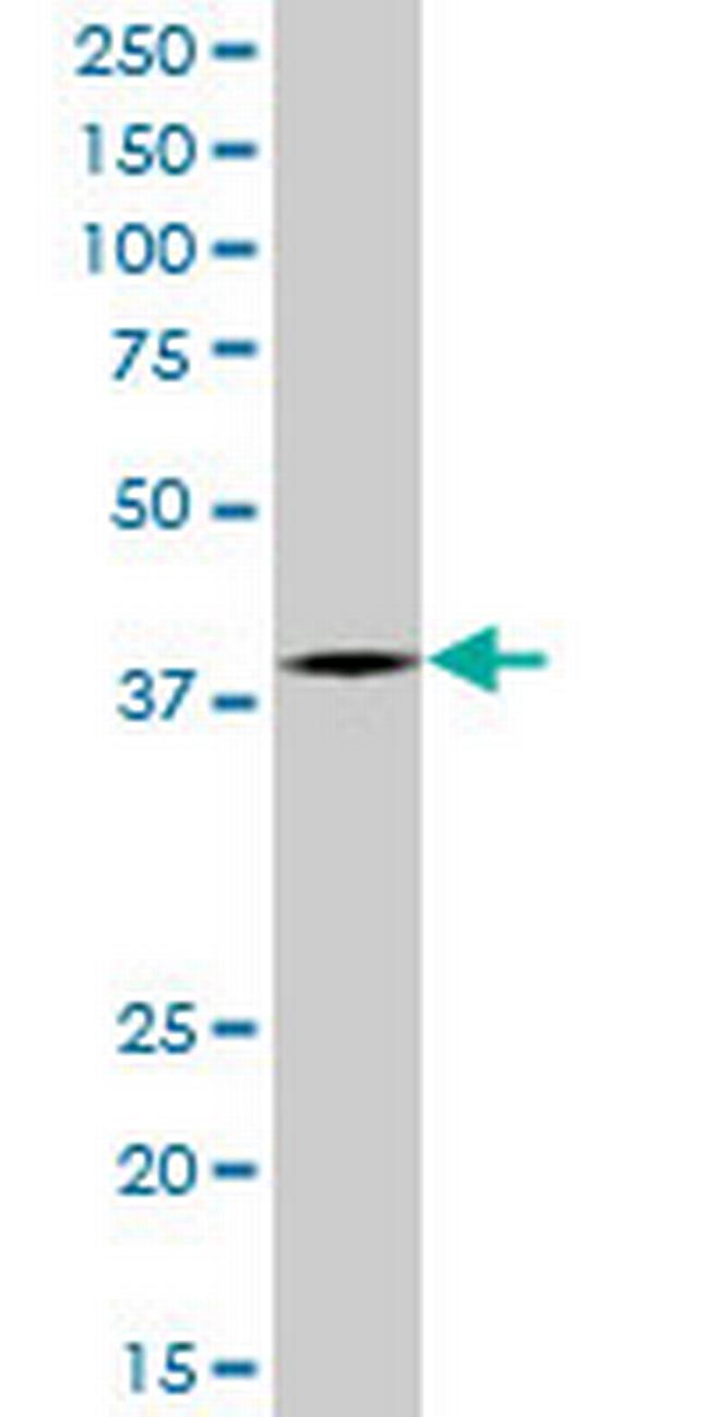 PCGF2 Antibody in Western Blot (WB)