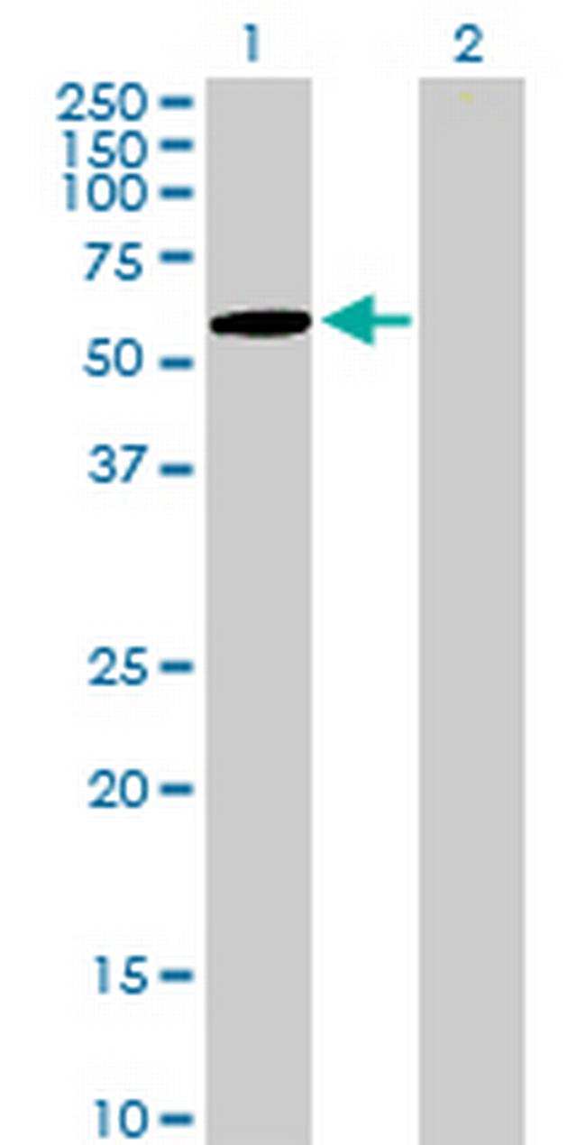 ZNF157 Antibody in Western Blot (WB)