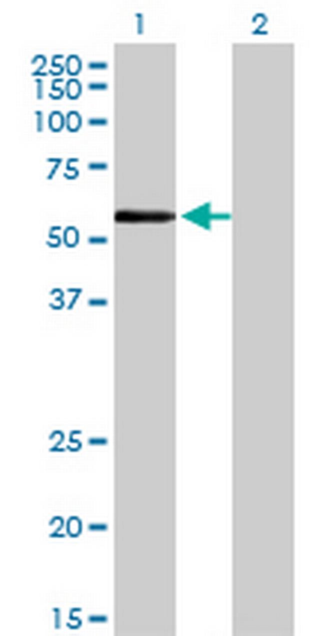 ZNF165 Antibody in Western Blot (WB)