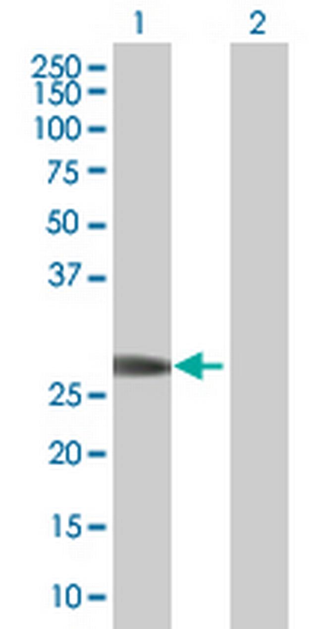 ZNF174 Antibody in Western Blot (WB)