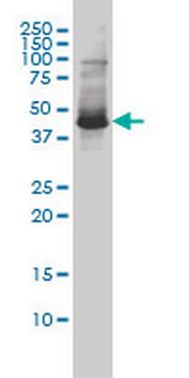 ZNF174 Antibody in Western Blot (WB)
