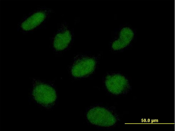RNF113A Antibody in Immunocytochemistry (ICC/IF)