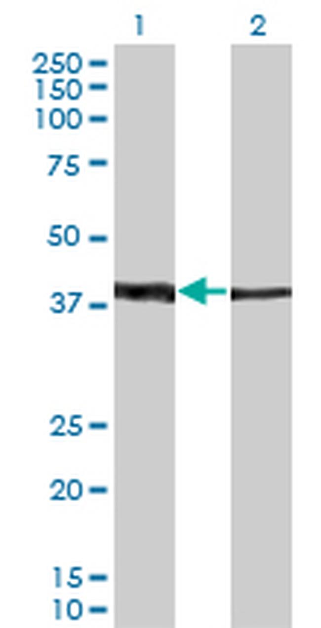 ZNF187 Antibody in Western Blot (WB)