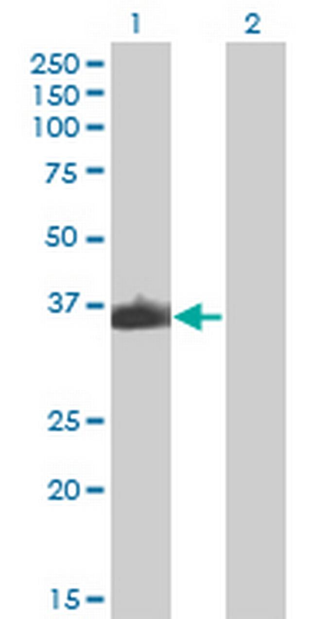 ZNF187 Antibody in Western Blot (WB)
