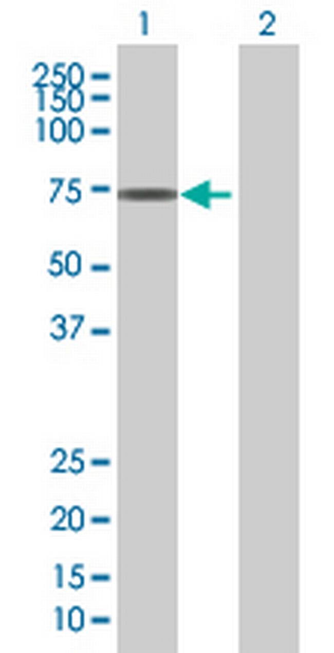 ZNF192 Antibody in Western Blot (WB)