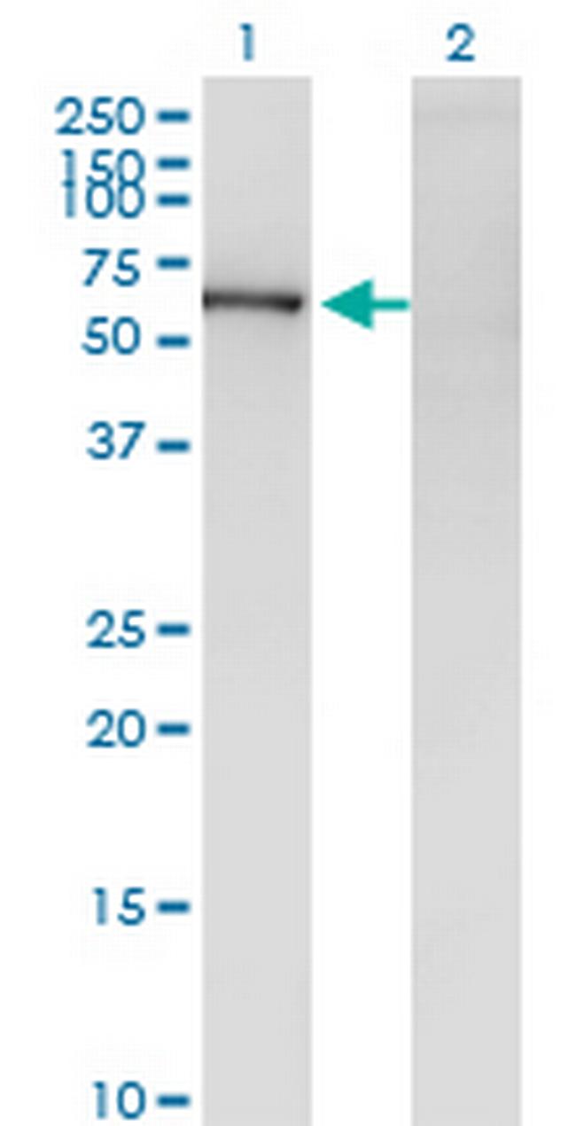 ZNF192 Antibody in Western Blot (WB)