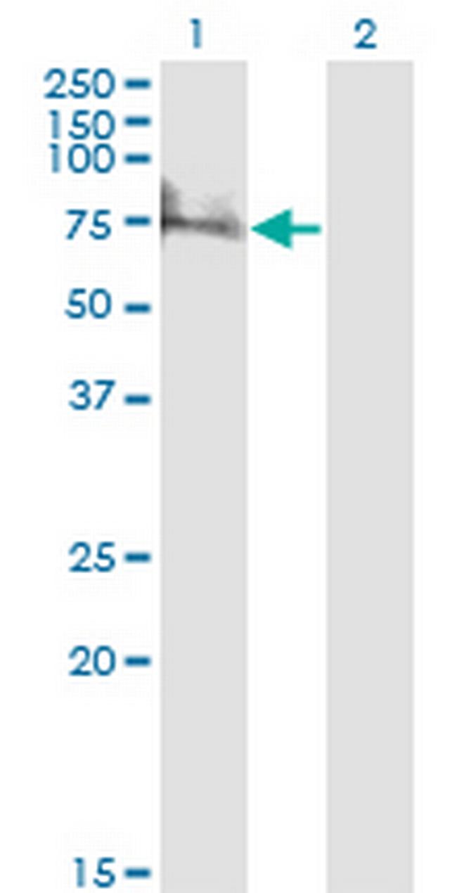 ZNF192 Antibody in Western Blot (WB)