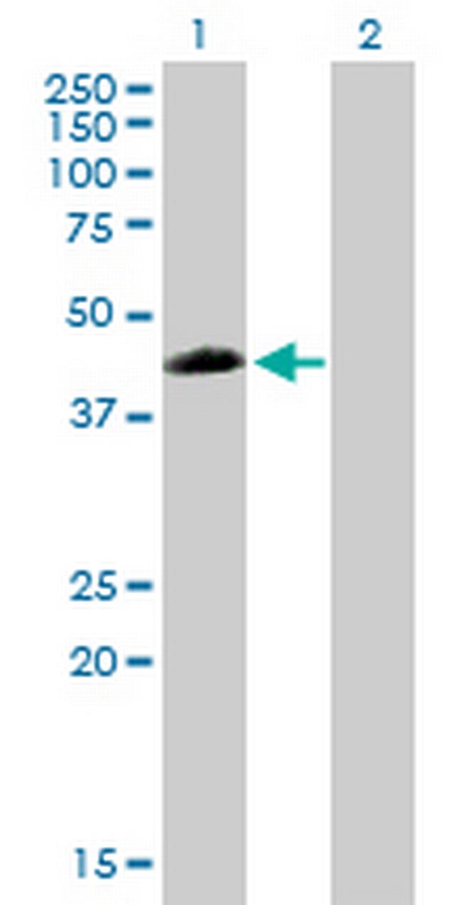 ZNF200 Antibody in Western Blot (WB)