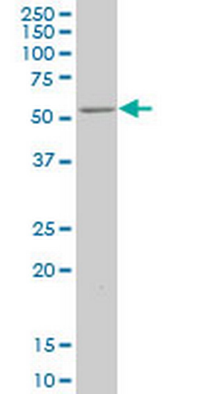 ZNF213 Antibody in Western Blot (WB)