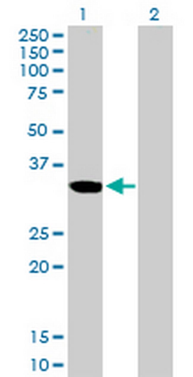 ZNF215 Antibody in Western Blot (WB)