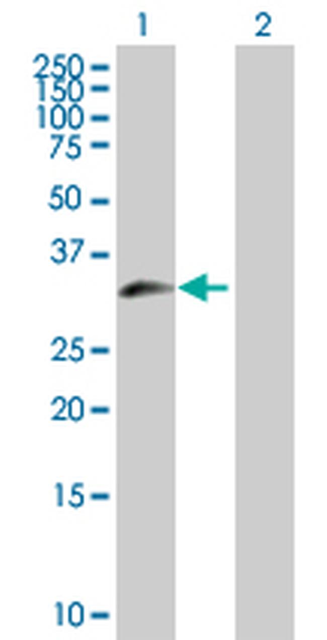 ZNF215 Antibody in Western Blot (WB)