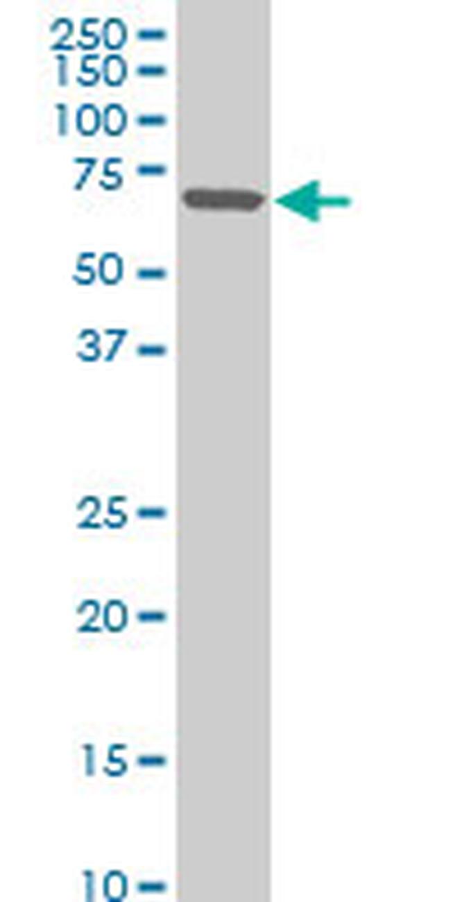 ZNF215 Antibody in Western Blot (WB)