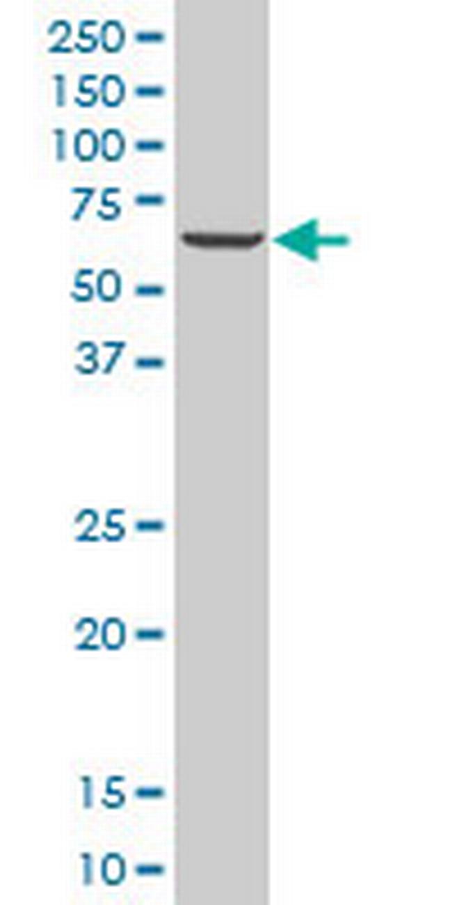ZNF215 Antibody in Western Blot (WB)