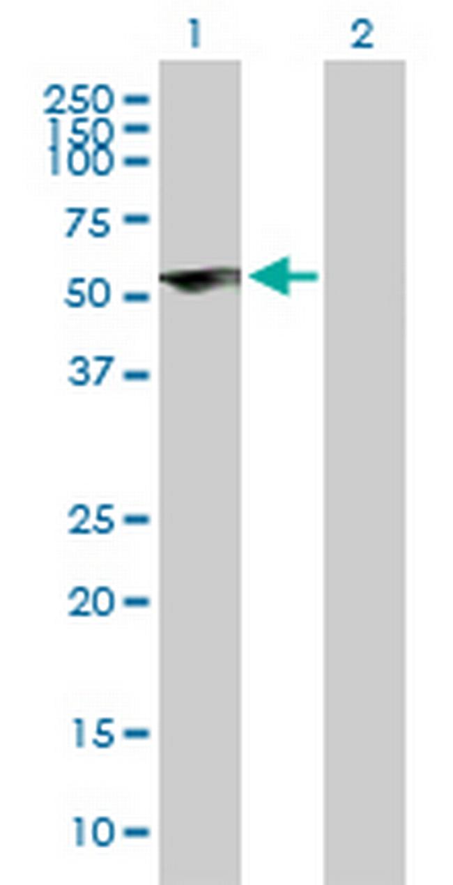 ZNF232 Antibody in Western Blot (WB)